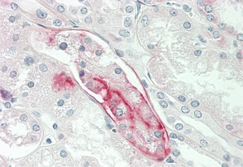 SLC44A2 Rabbit Polyclonal Antibody