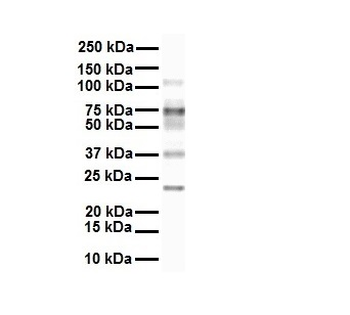SLC27A3 Rabbit Polyclonal Antibody