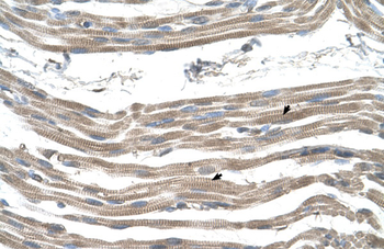 SLC25A22 Rabbit Polyclonal Antibody