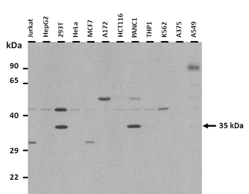SLC25A32 Rabbit Polyclonal Antibody