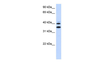SLC25A32 Rabbit Polyclonal Antibody