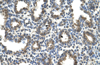 SLC37A3 Rabbit Polyclonal Antibody