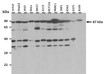 SLC26A9 Rabbit Polyclonal Antibody