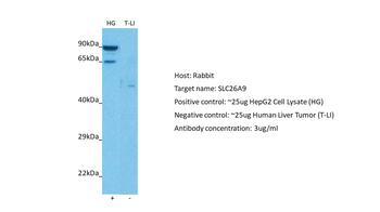 SLC26A9 Rabbit Polyclonal Antibody