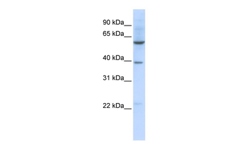 SLC35F3 Rabbit Polyclonal Antibody