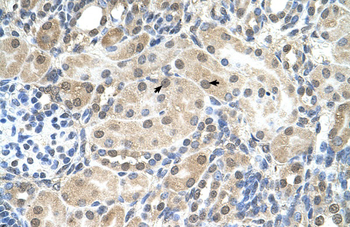 SLC9A9 Rabbit Polyclonal Antibody