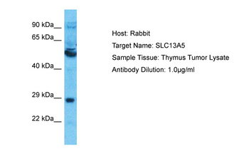 SLC13A5 Rabbit Polyclonal Antibody