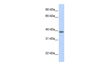 SLC25A42 Rabbit Polyclonal Antibody