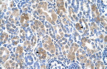 SLC36A3 Rabbit Polyclonal Antibody