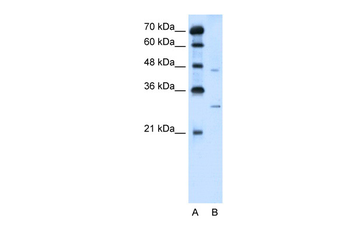 SLC36A3 Rabbit Polyclonal Antibody