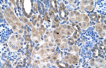 SLC6A18 Rabbit Polyclonal Antibody