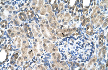 SLC19A1 Rabbit Polyclonal Antibody