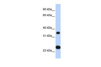 SLC25A35 Rabbit Polyclonal Antibody