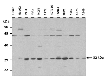SLC25A35 Rabbit Polyclonal Antibody