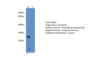 SLC25A35 Rabbit Polyclonal Antibody