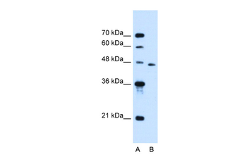 SLC16A12 Rabbit Polyclonal Antibody
