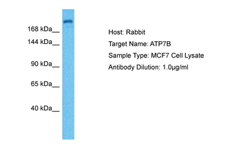 ATP7A Rabbit Polyclonal Antibody