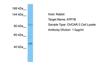 ATP7A Rabbit Polyclonal Antibody
