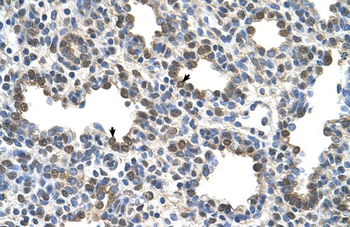 BCHE Rabbit Polyclonal Antibody