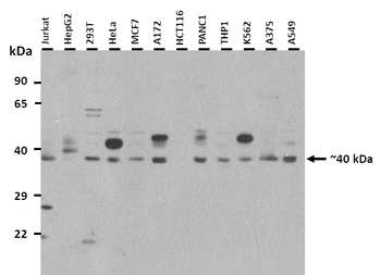 G6PC Rabbit Polyclonal Antibody