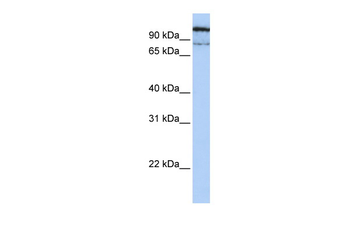 GAA Rabbit Polyclonal Antibody