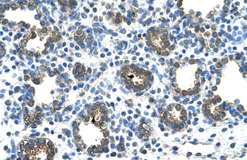 GUSB Rabbit Polyclonal Antibody