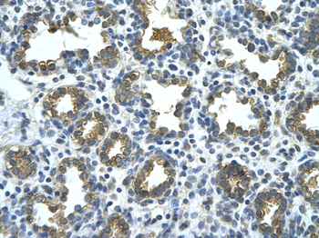 GUSB Rabbit Polyclonal Antibody