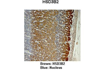 HSD3B2 Rabbit Polyclonal Antibody