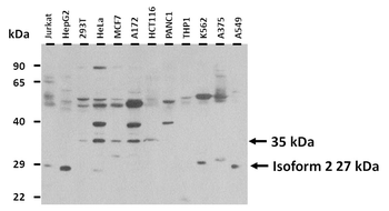 SGCB Rabbit Polyclonal Antibody
