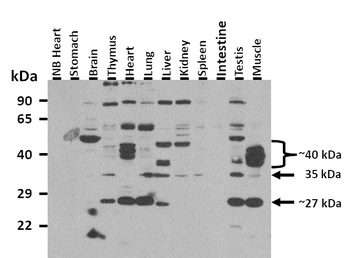 SGCB Rabbit Polyclonal Antibody