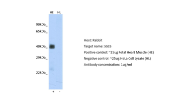 SGCB Rabbit Polyclonal Antibody