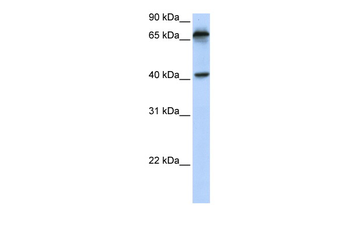 MICA Rabbit Polyclonal Antibody