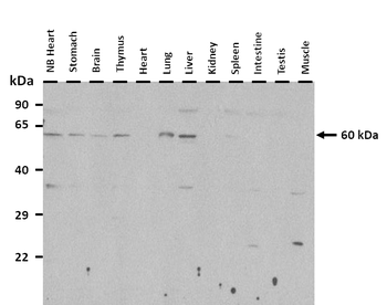 TYR Rabbit Polyclonal Antibody