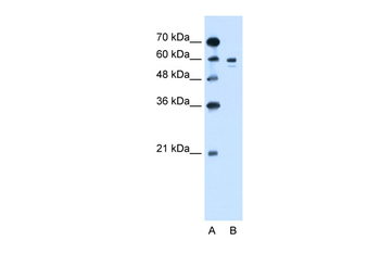 TYR Rabbit Polyclonal Antibody