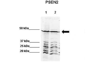 PSEN2 Rabbit Polyclonal Antibody