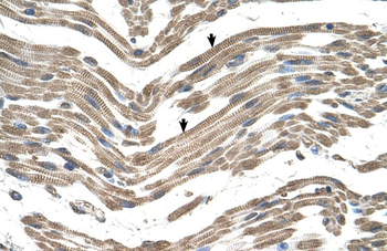 C1QB Rabbit Polyclonal Antibody