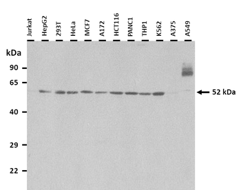 FGG Rabbit Polyclonal Antibody