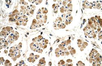 POR Rabbit Polyclonal Antibody
