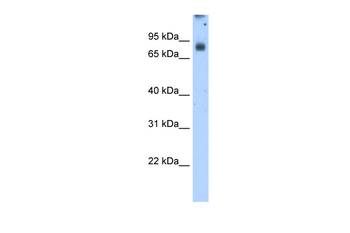 POR Rabbit Polyclonal Antibody