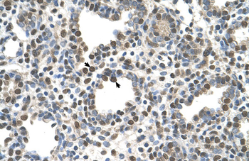 ZDHHC13 Rabbit Polyclonal Antibody