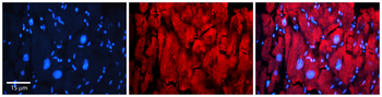 ATP2C1 Rabbit Polyclonal Antibody