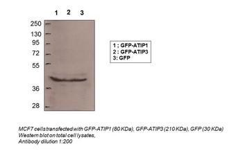 MTUS1 Rabbit Polyclonal Antibody