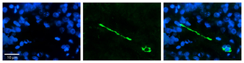 MTUS1 Rabbit Polyclonal Antibody