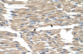 GPR177 Rabbit Polyclonal Antibody