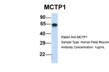 MCTP1 Rabbit Polyclonal Antibody