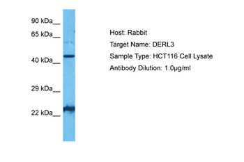 DERL3 Rabbit Polyclonal Antibody
