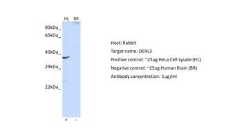 DERL3 Rabbit Polyclonal Antibody