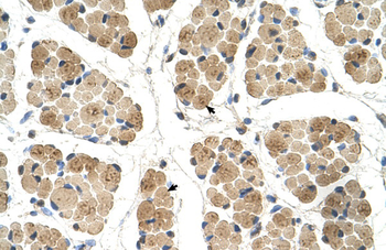 KLHL31 Rabbit Polyclonal Antibody