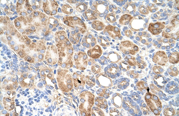 ALG11 Rabbit Polyclonal Antibody
