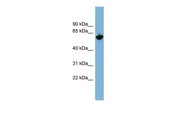 GPNMB Rabbit Polyclonal Antibody